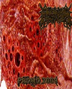 Diarreha Cronica : Promo 2009